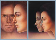 Rhinoplasty - Diagram
